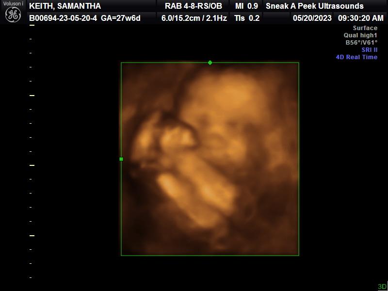 Sneak A Peek Ultrasounds In Beaumont TX Vagaro