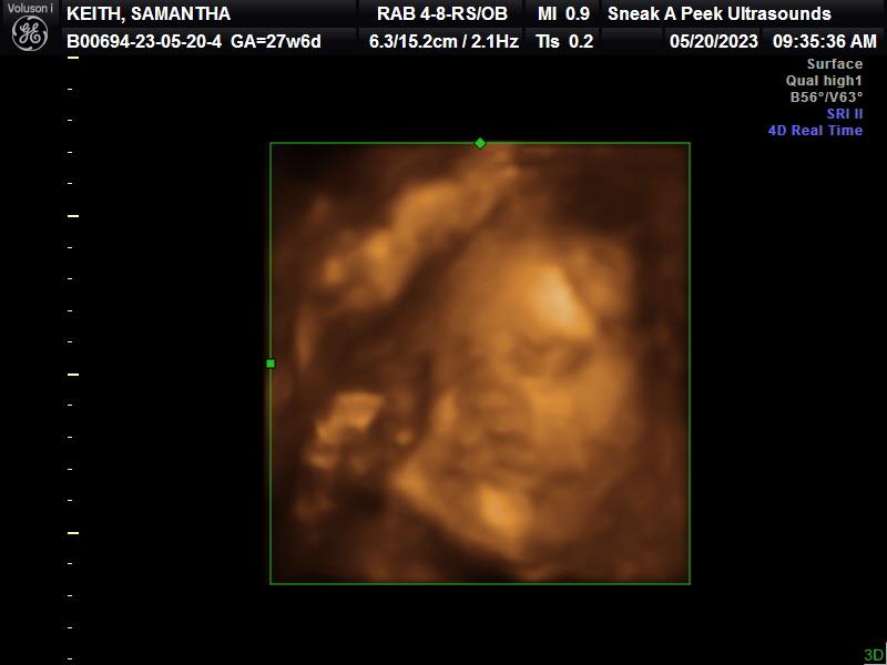 Sneak A Peek Ultrasounds In Beaumont TX Vagaro